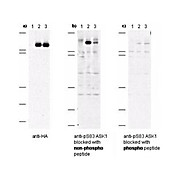 Anti-ASK1 pS83 (RABBIT) Antibody, 200µg, Liquid (sterile filtered)