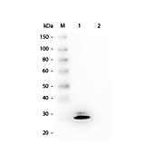 Anti-GSTO1 (MOUSE) Monoclonal Antibody, 100µg, Liquid (sterile filtered)