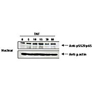 Anti-NFKB p65 (Rel A) pS529 (RABBIT) Antibody, 100µL, Liquid (sterile filtered)