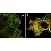 Anti-AKT pS473 (MOUSE) Monoclonal Antibody, 1mg, Liquid (sterile filtered)