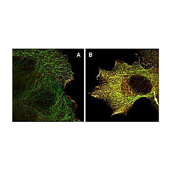 Anti-AKT pS473 (MOUSE) Monoclonal Antibody, 1mg, Liquid (sterile filtered)