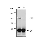 Anti-PI3-kinase p110 d (delta subunit) (RABBIT) Antibody, 100µL, Liquid (sterile filtered)