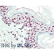 Anti-IPO-38 (MOUSE) Monoclonal Antibody, 100µg, Liquid (sterile filtered)