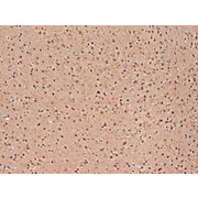 Kv2.1 Extracellular [S39-25] 100µg