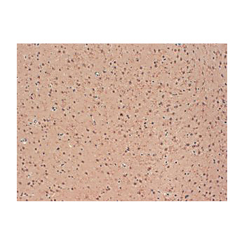 Kv2.1 Extracellular [S39-25] 100µg