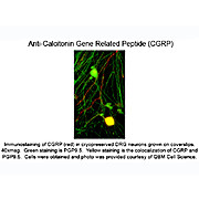 CGRP Antibody [4901] 100µL