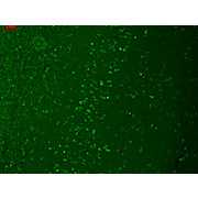 Anti-Trpm7 (MOUSE) Monoclonal Antibody, 100µg, Liquid (sterile filtered)