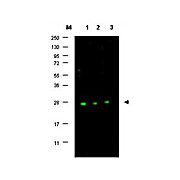 Anti-p27 (RABBIT) Antibody, 100µL, Liquid (sterile filtered)