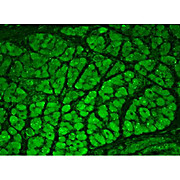 CaMKII Antibody peptide [22B1] 100µg
