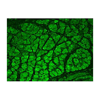 CaMKII Antibody peptide [22B1] 100µg
