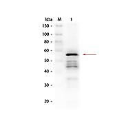 Anti-ALDEHYDE DEHYDROGENASE (Yeast) (RABBIT) Antibody, 2mL, Lyophilized