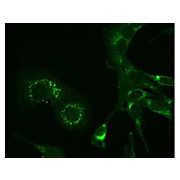 Anti-Hepatitis Virus (Strain A59) Nonstructural Protein 9 (nsp9) (MOUSE) Monoclonal Antibody, 100µg, Liquid (sterile filtered)