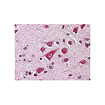 Anti-Protective Protein/Cathepsin A (PPCA) (RABBIT) Antibody, 200µL, Liquid (sterile filtered)