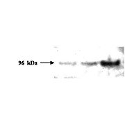 Anti-PMS2 (MOUSE) Monoclonal Antibody, 100µg, Liquid (sterile filtered)