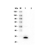 Anti-GSTZ1 (MOUSE) Monoclonal Antibody, 100µg, Liquid (sterile filtered)
