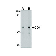 Anti-CD4 (MOUSE) Antibody, 100µg, Liquid[9H5A8]  (sterile filtered)