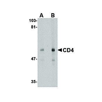 Anti-CD4 (MOUSE) Antibody, 100µg, Liquid[9H5A8]  (sterile filtered)