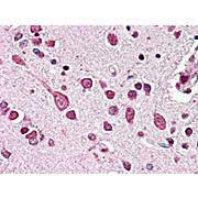 Anti-Cul7 (C-terminal specific) (RABBIT) Antibody, 100µL, Liquid (sterile filtered)