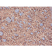 Anti-GABA-A Receptor beta 3 (MOUSE) Monoclonal Antibody, 100µg, Liquid (sterile filtered)