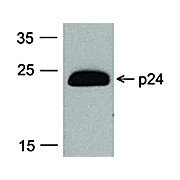 HIV-1 p24 Antibody [7F4] HRP Conj 100µg