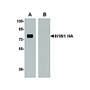 Anti-Seasonal H1N1 Hemagglutinin (MOUSE) Antibody, 100µg, Liquid (sterile filtered)