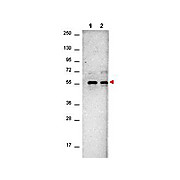 Anti-AKT (MOUSE) Monoclonal Antibody, 1mg, Liquid (sterile filtered)