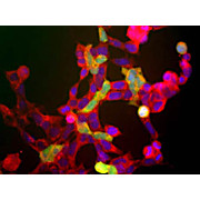 Anti-Neuron specific enolase (NSE) (Rabbit) Antibody, 100µL, Liquid