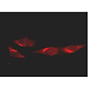 Anti-p53 (MOUSE) Monoclonal Antibody, 100µg, Liquid (sterile filtered)