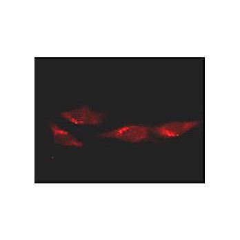Anti-p53 (MOUSE) Monoclonal Antibody, 100µg, Liquid (sterile filtered)
