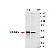 Anti-CATALASE (RABBIT) Antibody, 2mL, Lyophilized