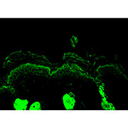 Anti-Calreticulin (RABBIT) Antibody, 200µL, Liquid (sterile filtered)