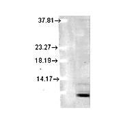 Ubiquitin Antibody [5B9-B3] 200µg