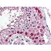 Anti-Cul4A (N-terminal specific) (RABBIT) Antibody, 100µL, Liquid (sterile filtered)