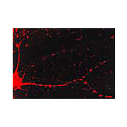 CaMKII Antibody [6G9] 100µg