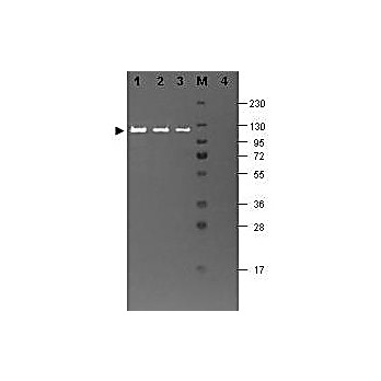 Anti-BETA GALACTOSIDASE (E.coli) (RABBIT) Antibody, 2mL, Lyophilized