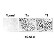 Anti-ATM Protein Kinase pS1981 (MOUSE) Monoclonal Antibody, 100µg, [7C10D8 Liquid (sterile filtered)