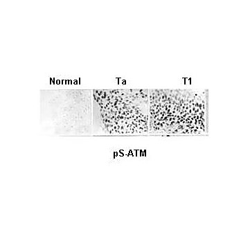 Anti-ATM Protein Kinase pS1981 (MOUSE) Monoclonal Antibody, 100µg, [7C10D8 Liquid (sterile filtered)