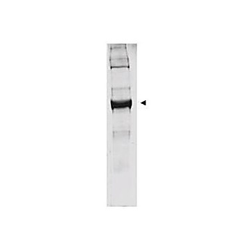 Anti-GLUTAMATE DEHYDROGENASE (Bovine Liver) (RABBIT) Antibody, 2mL, Lyophilized