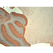 Anti-IP3 Receptor (MOUSE) Monoclonal Antibody, 100µg, Liquid (sterile filtered)