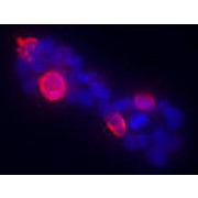 Anti-Gli1 (RABBIT) Antibody, 100µL, Liquid (sterile filtered)