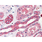 Anti-THYMIDYLATE SYNTHASE (SHEEP) Antibody, 2mL, Lyophilized
