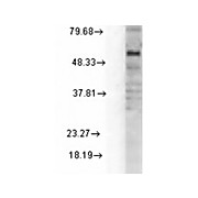Anti-GABA-A Receptor delta (MOUSE) Monoclonal Antibody, 100µg, Liquid (sterile filtered)