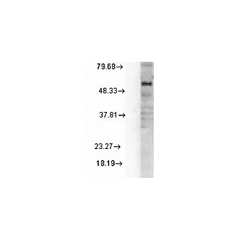 Anti-GABA-A Receptor delta (MOUSE) Monoclonal Antibody, 100µg, Liquid (sterile filtered)