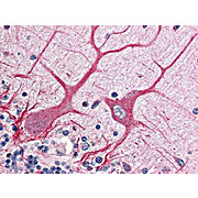 Anti-NOTCH 1 (intra) (RABBIT) Antibody, 200µL, Liquid (sterile filtered)