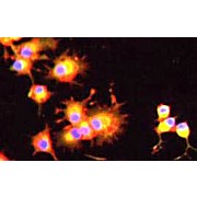 Anti-Angiopoietin 2 (RABBIT) Antibody, 200µL, Liquid (sterile filtered)