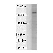 Anti-GABA-A Receptor alpha 1 protein (MOUSE) Monoclonal Antibody, 100µg, Liquid (sterile filtered)
