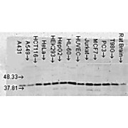 Anti-p38 alpha MAPKinase (MOUSE) Monoclonal Antibody, 100µg, Liquid (sterile filtered)