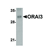 ORAI3 Antibody [1B4F1] 100µg