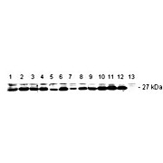 Anti-BCL2 (RABBIT) Antibody, 200µg, Liquid (sterile filtered)