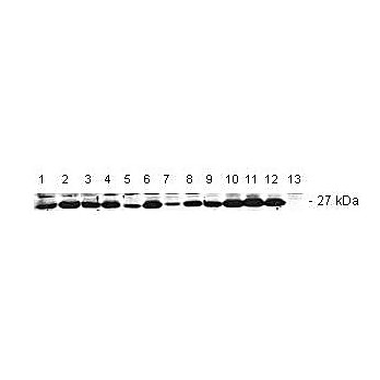 Anti-BCL2 (RABBIT) Antibody, 200µg, Liquid (sterile filtered)